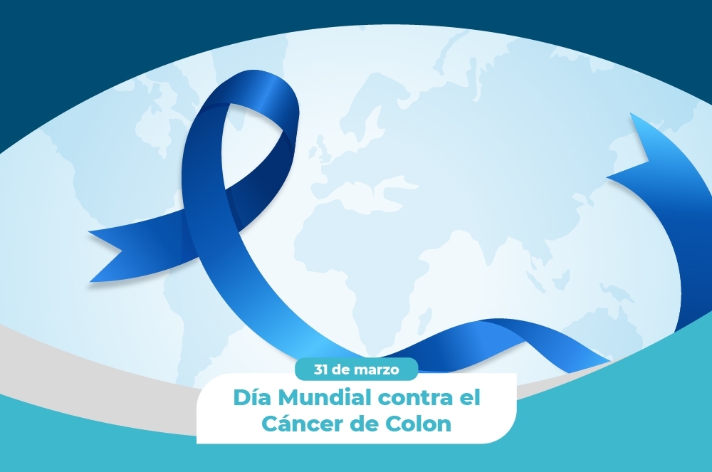 La importancia de la prevención: Cáncer del Colon